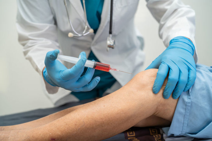 Médecin injectant de l'acide hyaluronic dans le genou d'un malade souffrant d'arthrose
