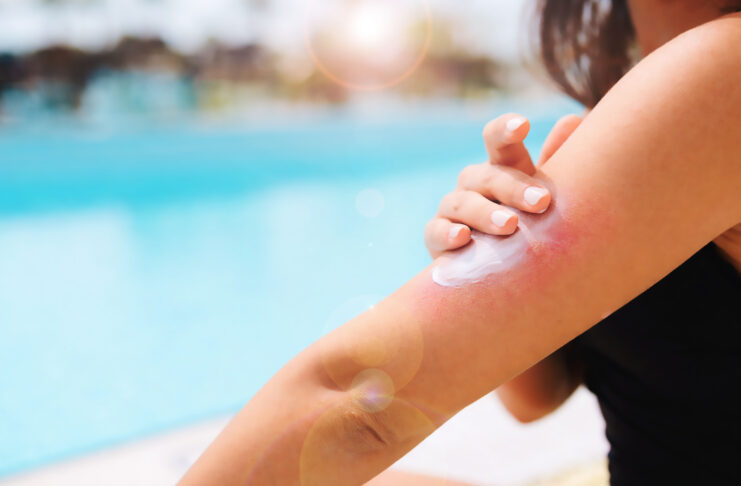 Psoriasis : mieux vivre la maladie