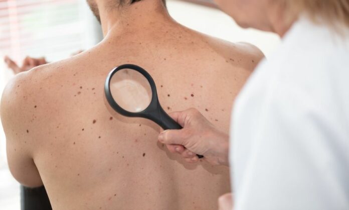 277594234 - dermatologist examining the skin of patient back